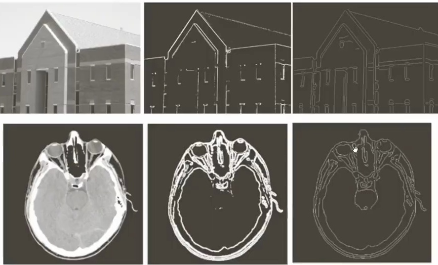 Three-panel comparison showing edge detection on medical brain scan